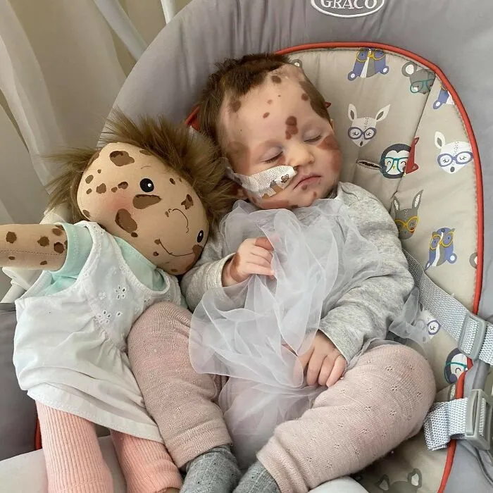 Woman Creates Inclusive Dolls Representing Their Owners That Face Rare Health Conditions (30 Pics)