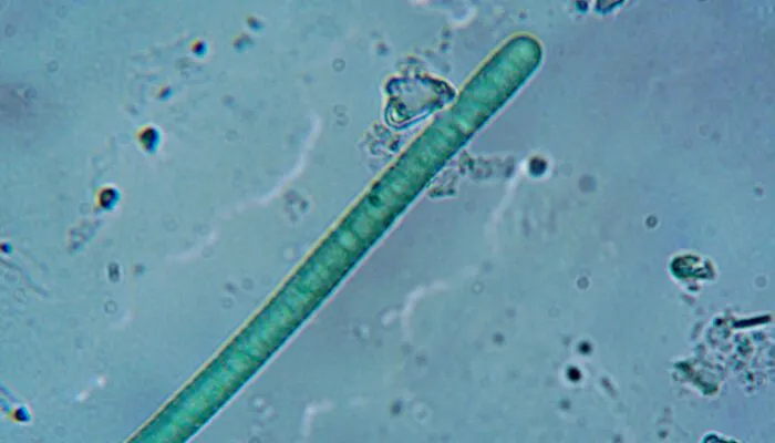 Worms Living In Chernobyl Exclusion Zone Have Super Ability That Humans Don't Have