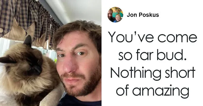Before And After Of Man Who Received “Amazing” Nasal Reconstruction After Getting Mauled By Dog