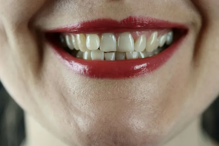 “What Is Actually Healthy But People Think It Is Not?” (30 Answers)