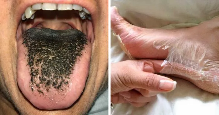 50 Times People Came Across Something ‘Mildly Disgusting’ And Had To Share In This Group