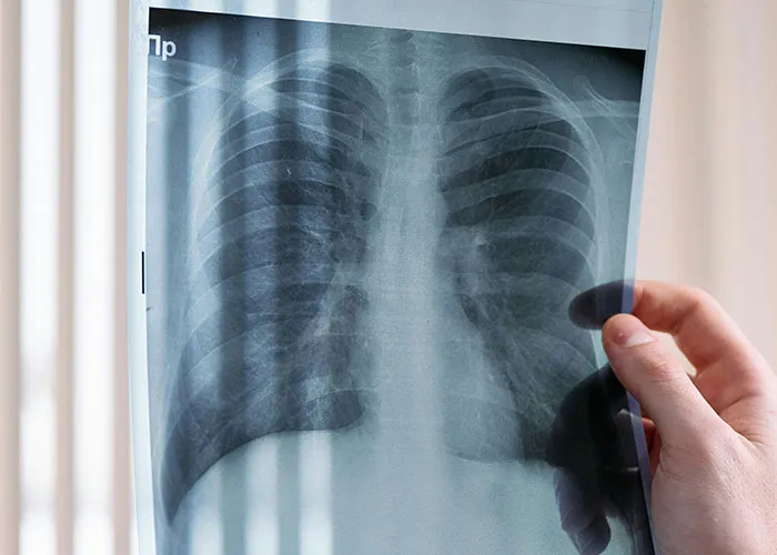 35 Things People Assumed Were Normal About Their Bodies Until Someone Pointed Out Otherwise