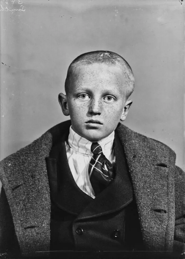 20 Haunting Medical Portraits Of Harvey Cushing's Patients In The Early 20th Century