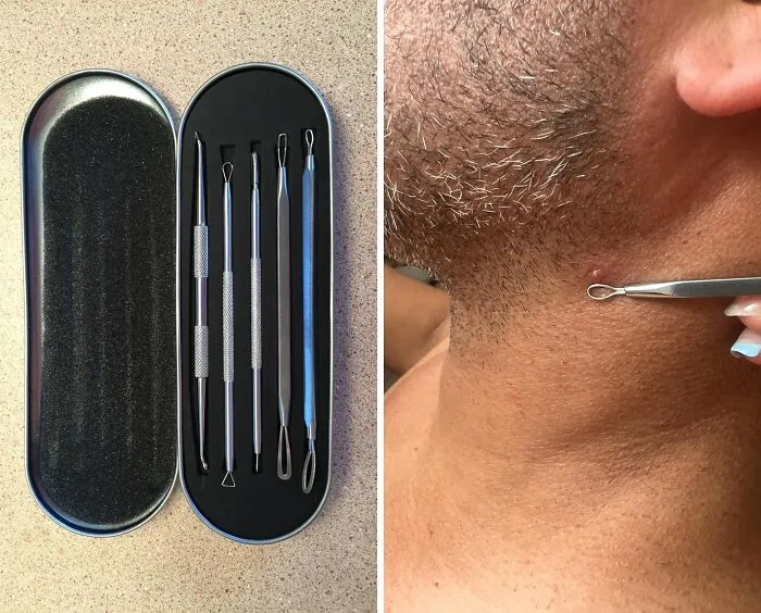 Experience Clearer Skin With <span Style="Font:inherit;color:#d74b1f;"> The Pimple Popper Tool Kit</Span>: Your Set For Blemish-Free Complexion