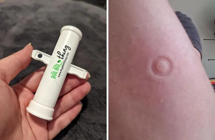 Soothe Away Irritation With Natural <span Style="Font:inherit;color:#d74b1f;"> Insect Bite Relief</Span>: Your Go-To Remedy For Outdoor Comfort