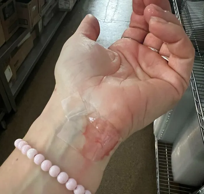 No hay tiritas, así que me puse cinta adhesiva, tenía que terminar el turno y evitar que lo vieran los clientes. No era un corte serio, pero, ¿cómo no hay tiritas en un restaurante?