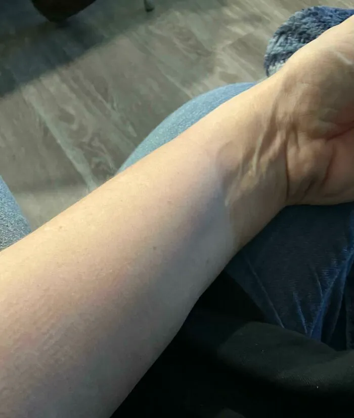 Hoy me voy a hacer un tatuaje. Esta es una foto del antes