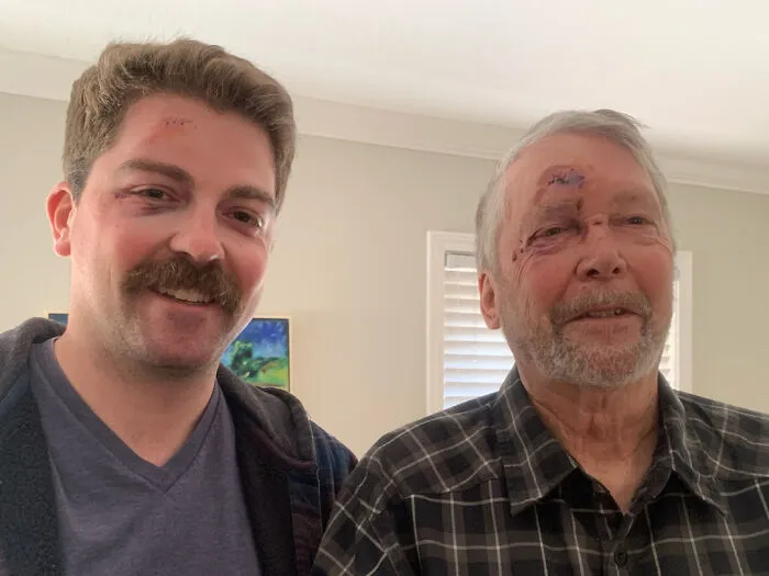 My Dad And I Both Fell On The Same Day. Same Injuries, Same Number Of Stitches. 8 Hours Between