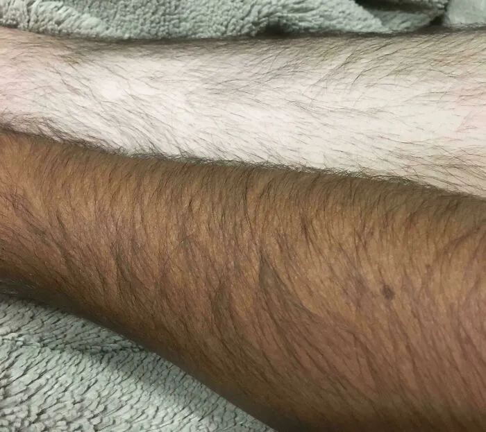 My Tanned And Untanned Skin Tones Are Drastically Different