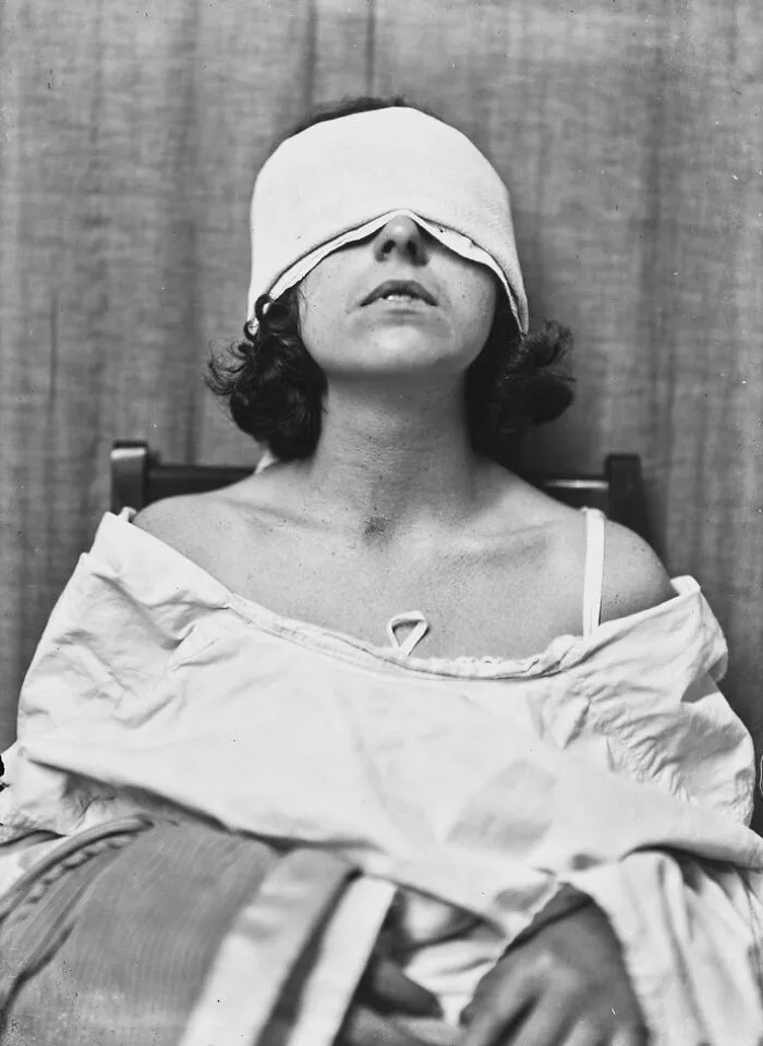 20 Haunting Medical Portraits Of Harvey Cushing's Patients In The Early 20th Century