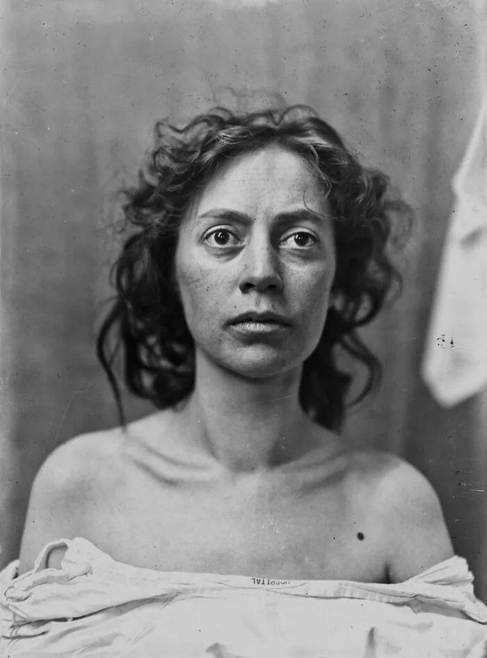 20 Haunting Medical Portraits Of Harvey Cushing's Patients In The Early 20th Century