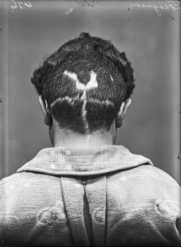 20 Haunting Medical Portraits Of Harvey Cushing's Patients In The Early 20th Century