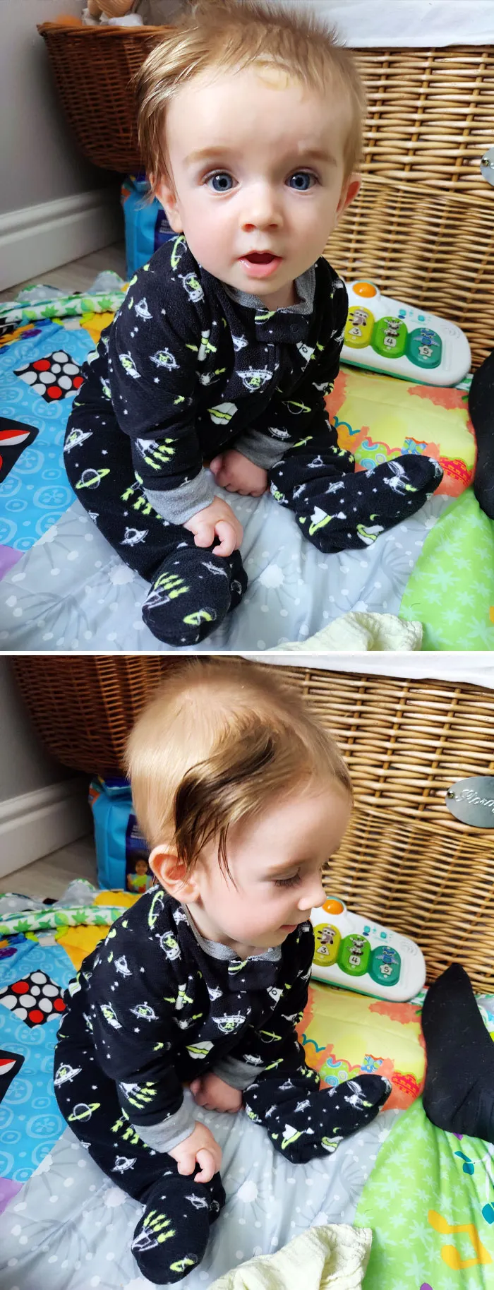 La marca de nacimiento de mi hijo le da un peinado genial