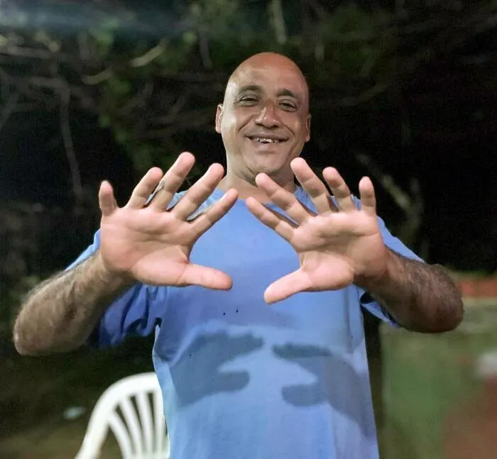 Este es Veinticuatro (24). Tiene 12 dedos en las manos y 12 en los pies