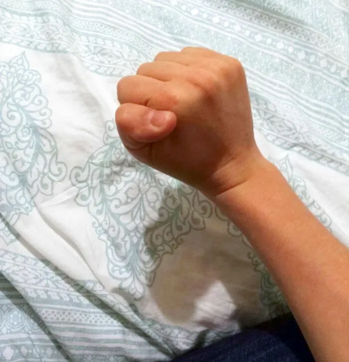Mi pulgar se dobla hacia atrás