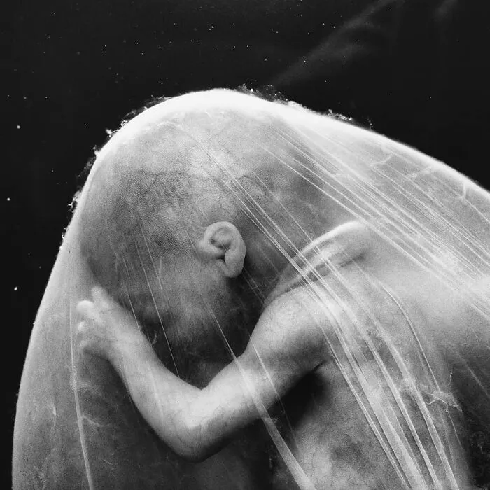 19 Groundbreaking Images By This Photographer Offering A Glimpse Into The Miracle Of Birth