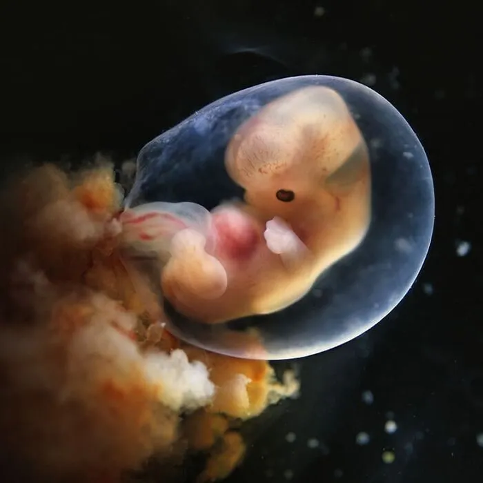 19 Groundbreaking Images By This Photographer Offering A Glimpse Into The Miracle Of Birth
