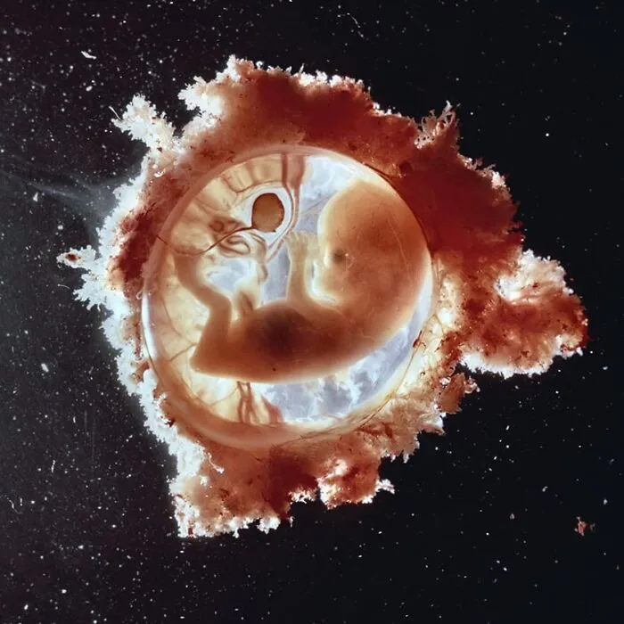 19 Groundbreaking Images By This Photographer Offering A Glimpse Into The Miracle Of Birth