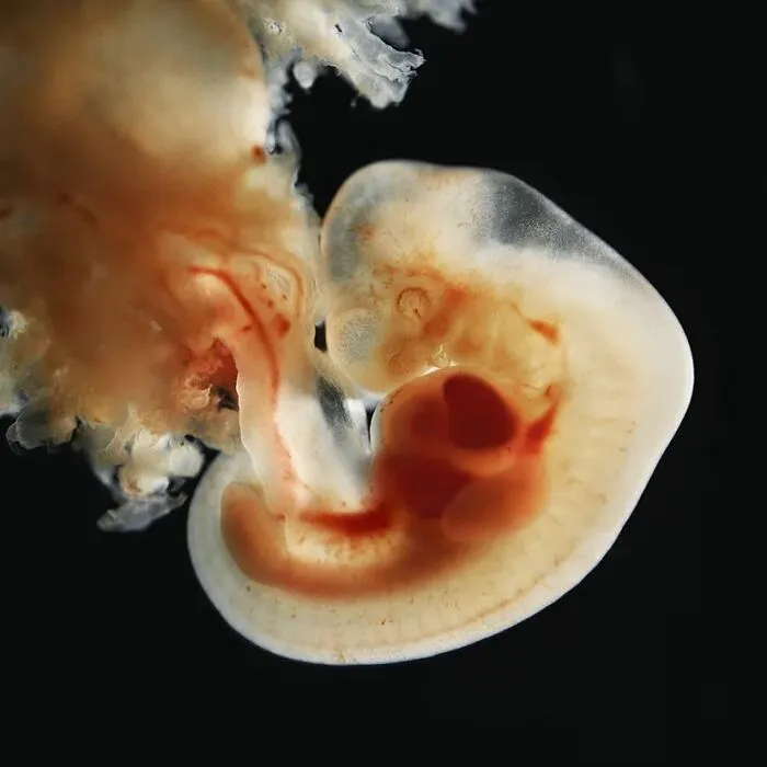 19 Groundbreaking Images By This Photographer Offering A Glimpse Into The Miracle Of Birth
