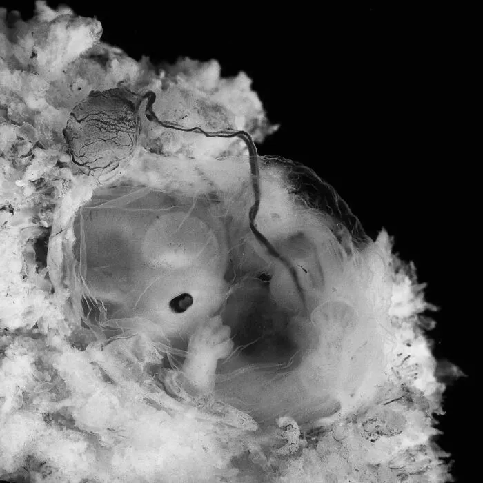 19 Groundbreaking Images By This Photographer Offering A Glimpse Into The Miracle Of Birth