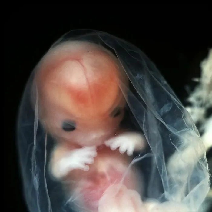 19 Groundbreaking Images By This Photographer Offering A Glimpse Into The Miracle Of Birth