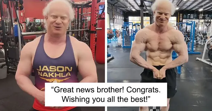Blind, Albino Personal Trainer Shares Update After Being Forced To Quit Because Of “Lack Of Clients”