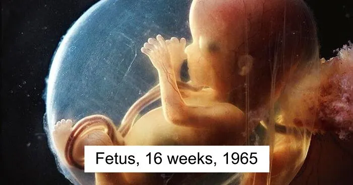19 Groundbreaking Images By This Photographer Offering A Glimpse Into The Miracle Of Birth