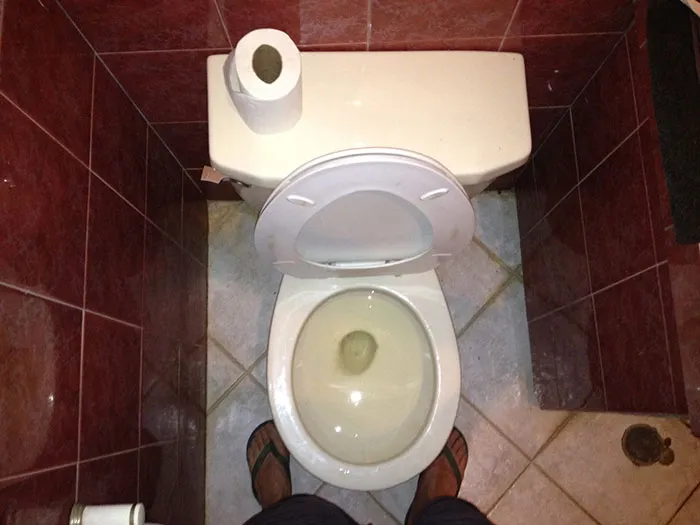 Someone Asks People To Share The Grossest Thing Their Partner Does, And 30 Don't Hold Back