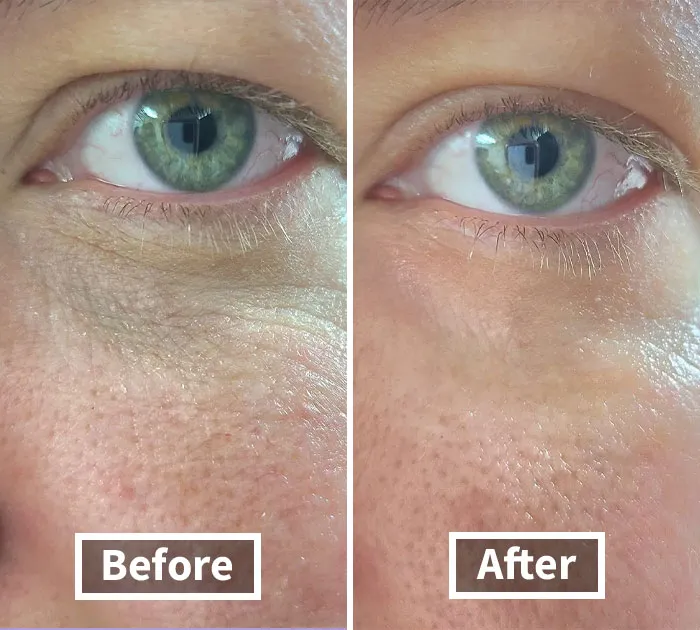 Revive Your Under-Eyes With This <a Style="Display:inline;" Href="Https://Www.amazon.com/Dp/B00jjpmxdo?ascsubtag=7634304%2c1%2c35%2cd%2c0%2c0%2c0%2c900%3a2%3b974%3a2%3b1125%3a3%3b1242%3a1%2c44148569%2c0%2c0%2c0&linkcode=ll1&tag=bpcobra-20&linkid=3d3bb7131339a250fe1e6f3e9da0e162&language=en_us&ref_=as_li_ss_tl" Target="_blank"><span Style="Font: Inherit; Color: #d74b1f;"> CeraVe Undereye Repair Cream</Span> And Banish Those End-Of-Year Dark Circles. Looking Fresh Has Never Been Easier!