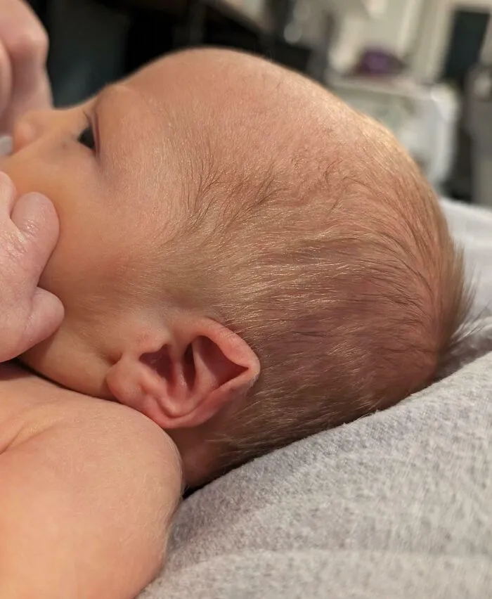 My Son Was Born With Elf Ears