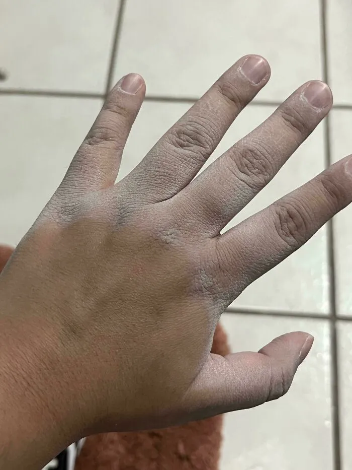 Esto me pasa cada vez que entro en contacto con agua caliente