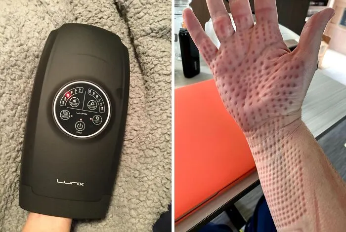This<span Style="Font:inherit;color:#d74b1f;"> Lunix Hand Massager</Span> Gets 2 Thumbs Up From Netizens With Tired Paws