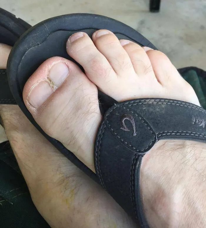 Este amigo tiene doble pulgar en el pie, y juega al futbol