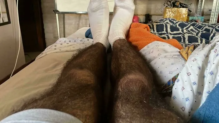 My Hairy Legs