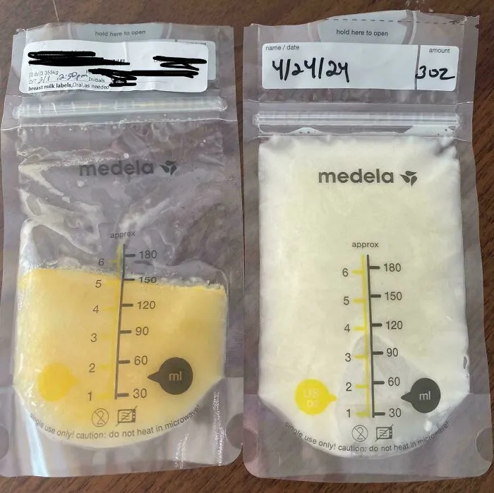 Diferencia de color en leche materna 3 días tras el parto vs 8 semanas tras el parto