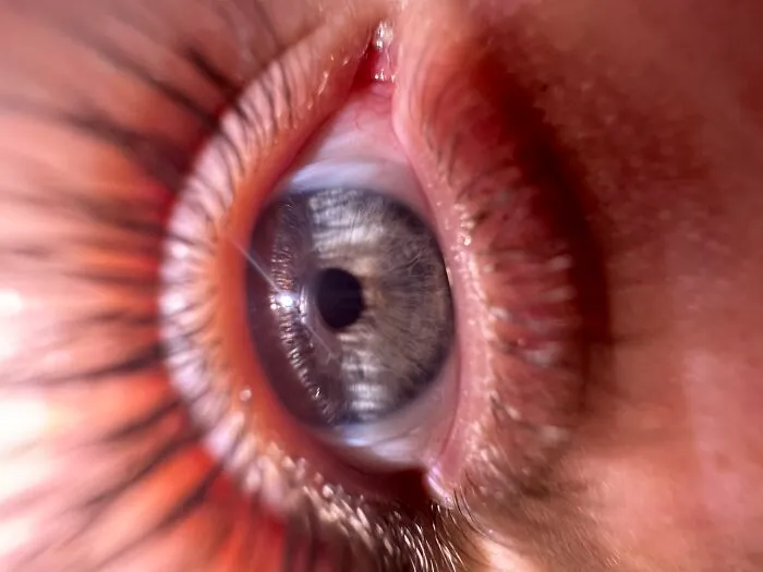 My Eye