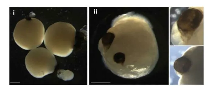 Los científicos cultivaron "mini-cerebros" con células madre. Luego, de algún modo, desarrollaron ojos