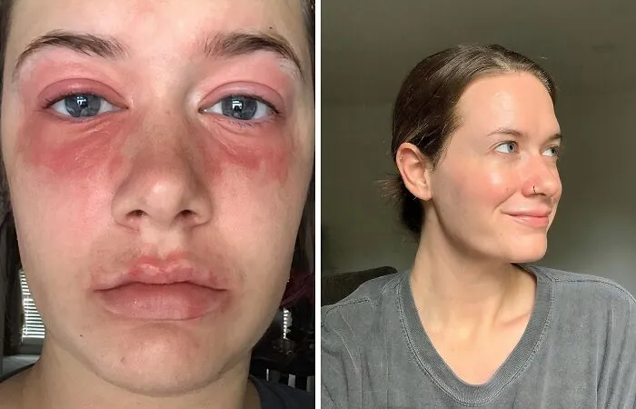 Don’t Let Problematic Skin Slow You Down. Try This<span Style="Font:inherit;color:#d74b1f;"> Cosrx Snail Mucin Repairing Essence </Span>