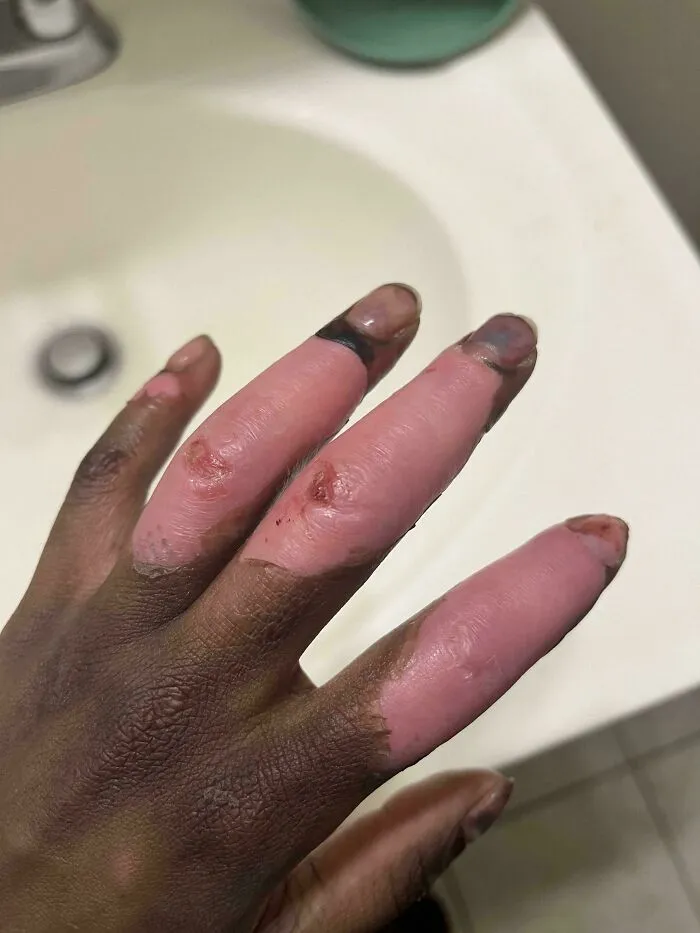 Debajo de mi piel soy rosa