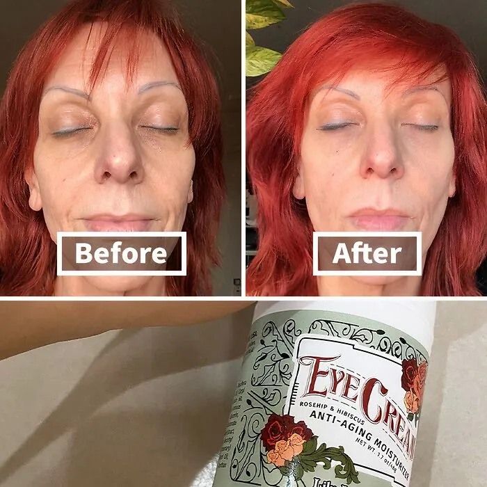 No Cream Can Turn Back The Hands Of Time, But This<span Style="Font:inherit;color:#d74b1f;"> Anti-Aging Eye Cream For Dark Circles And Puffiness </Span> Is Doing The Most!