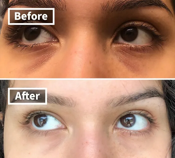 <span Style="Font:inherit;color:#d74b1f;"> Cerave’s Eye Repair Cream </Span> Is In One Word… Eye-Conic!