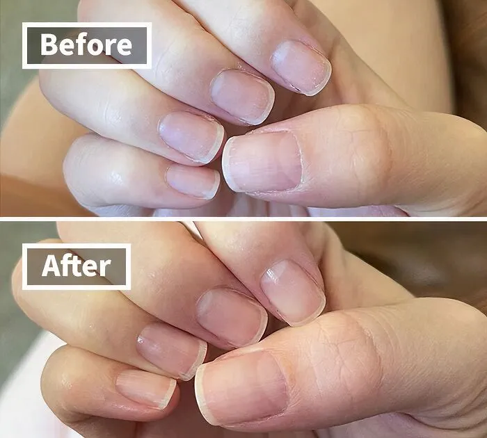 <a Style="Display:inline;" Href="Https://Www.amazon.com/Cnd-Essentials-Nail-Cuticle-Solaroil/Dp/B0037mimlw?ie=utf8&linkcode=ll1&tag=bpgorilla-20&linkid=44bbec2b9f1a78f4387d1f18c7c8fe85&language=en_us&ref_=as_li_ss_tl " Target="_blank"> They Really Hit The Nail On The Head When They Created This <span Style="Font:inherit;color:#d74b1f;"> Cuticle Oil </Span>