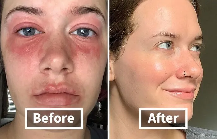 This <span Style="Font:inherit;color:#d74b1f;"> Hydrating Serum</Span> Will Take You From Thirsty To Thirstrap In No Time 