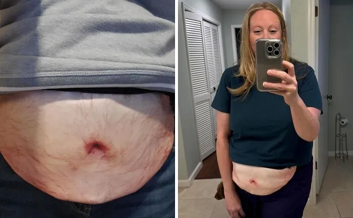 This <span Style="Font:inherit;color:#d74b1f;"> Belly Pack </Span> Turns The Dad Bod Into High Fashion