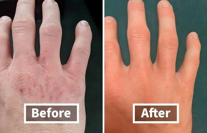 <span Style="Font:inherit;color:#d74b1f;"> Hand Cream For Extremely Dry, Cracked Hands </Span>: It's Ok If You Work Hard But Your Hands Don't Have To Show It