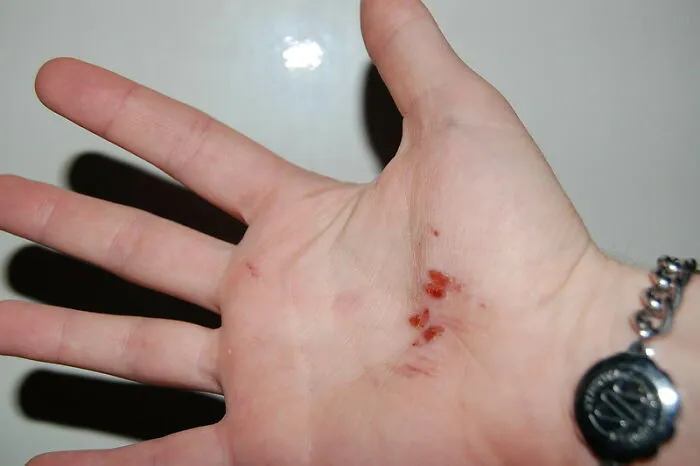 "The Check Engine Light Came On": 30 Body Changes People Experienced After Hitting 40