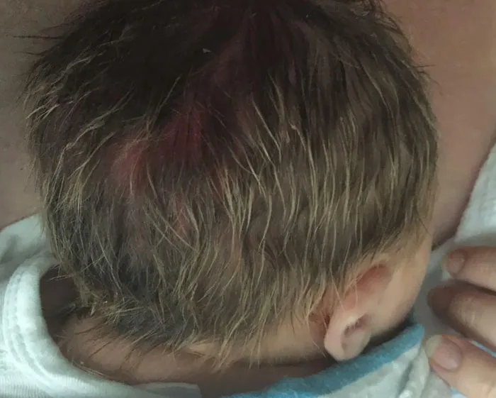 Mi hija ha nacido con mechas