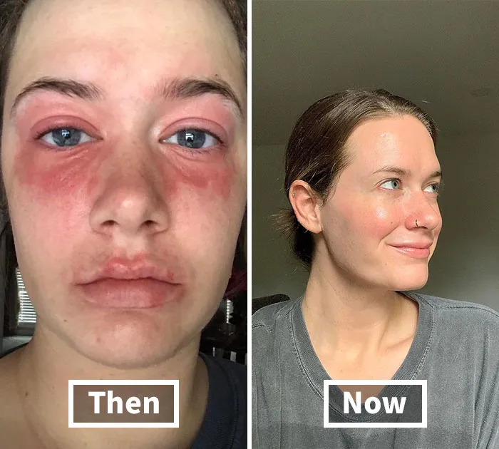 <span Style="Font:inherit;color:#d74b1f;"> Joseon Glow Serum </Span>  Is Coming To The Rescue To Help Your Mom Reclaim Her Sparkle!