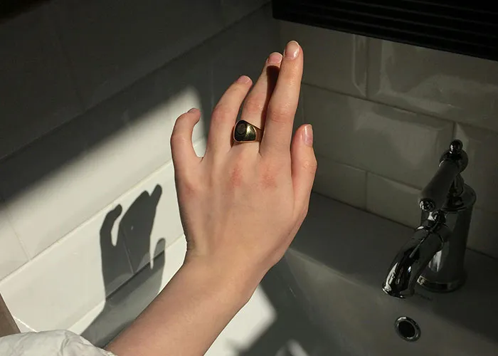 Improbable Doesn’t Mean Impossible: 35 Unlikely Events People Experienced