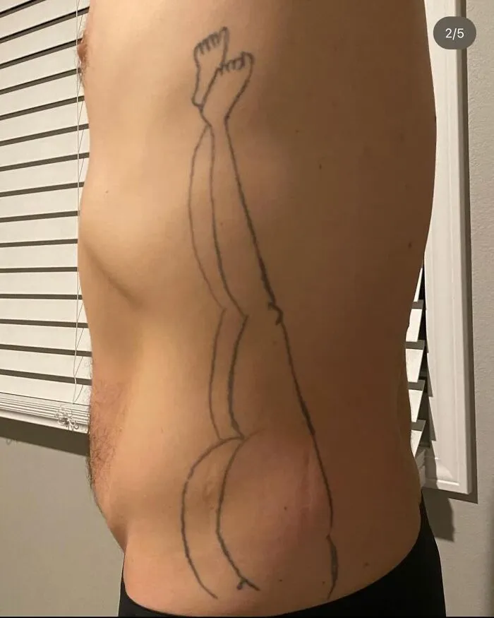 Found This On Instagram  They Did Get A Coverup Thank God.